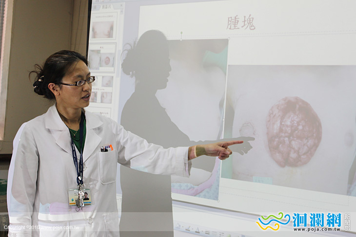 乳房纖維囊腫性疾病