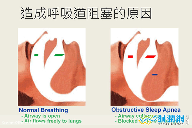 睡眠門診讓你睡好睡滿，打呼與呼吸中止掰掰！