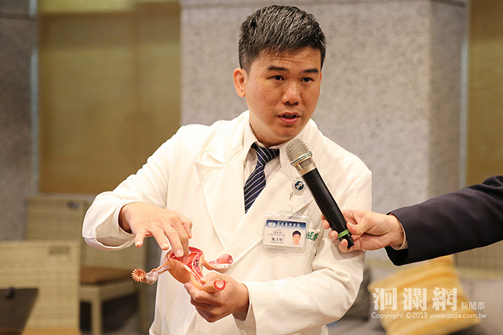 精準手術剛剛好，達文西螢光影像系統治療婦癌