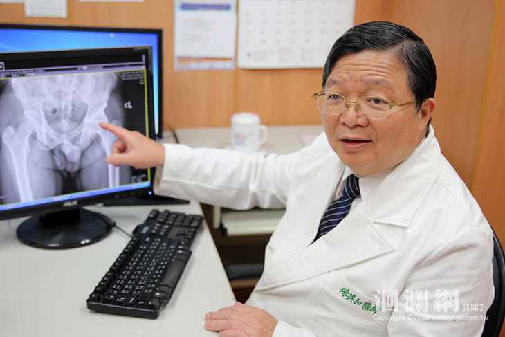 鼠蹊部疼痛十五年，馬國病人跨海求醫恢復健走