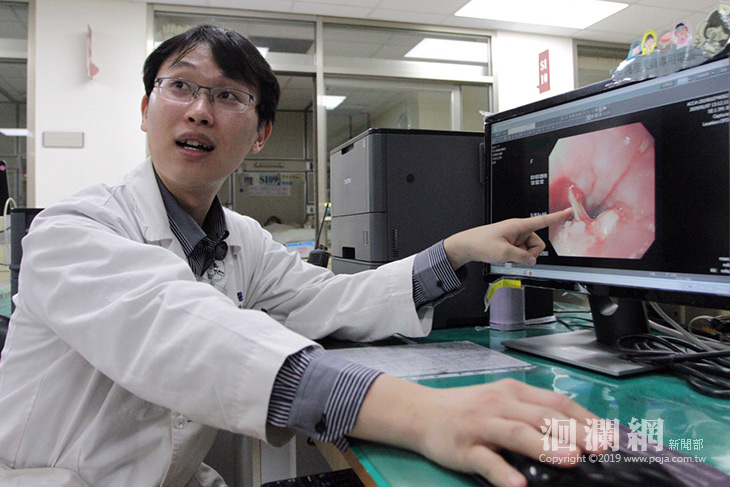 魚刺卡食道引發縱膈腔炎   醫師：致死率5成
