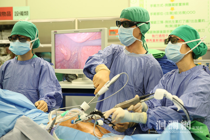 九旬嬤腹悶「吃不下、排不出」 3D腹腔手術切除