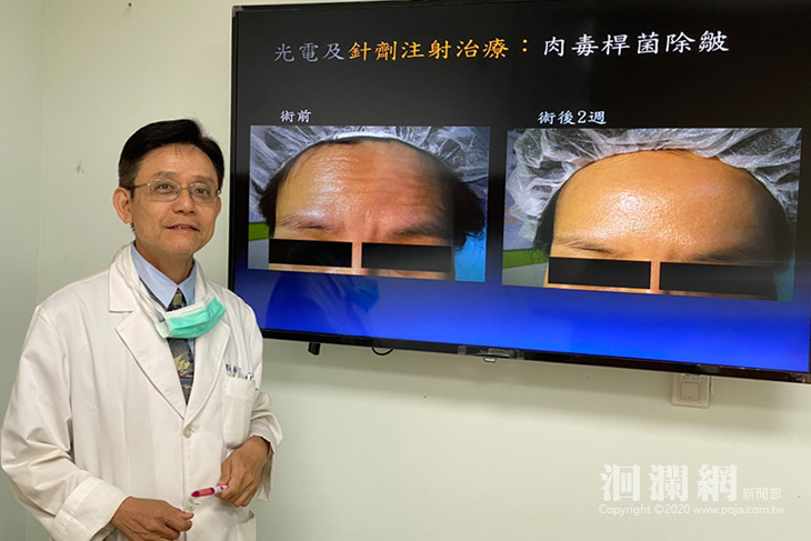 神奇的肉毒桿菌-花蓮醫院