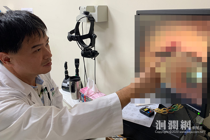 [慎入]嚇!!.眼睛莫名流血，竟是水蛭跑進去!?