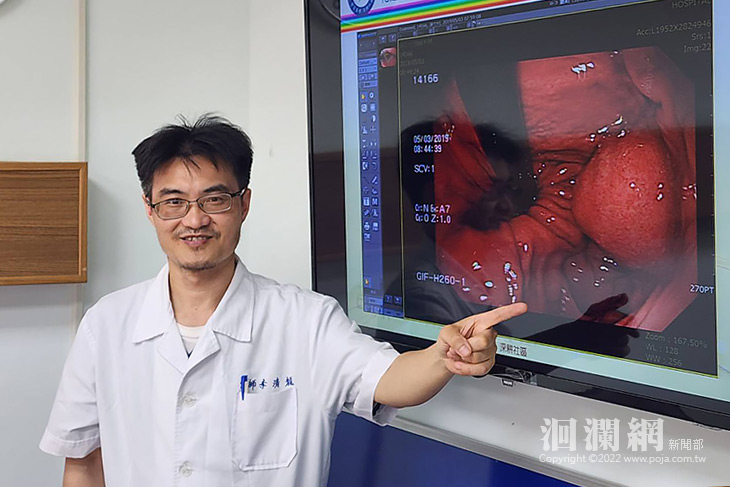 上腹悶痛症狀意外發現胃腸道基質腫瘤-花蓮醫院